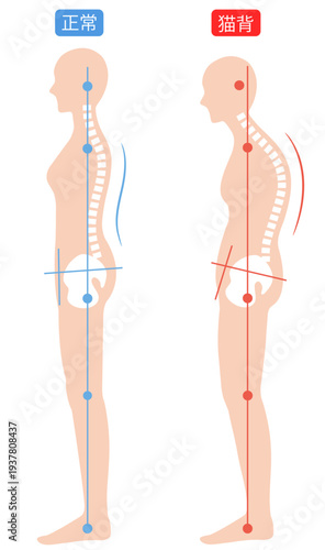 猫背と正しい姿勢　背骨と骨盤