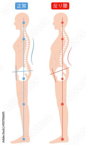 反り腰と正しい姿勢　背骨と骨盤