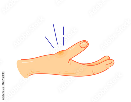 Arthritis or tendon inflammation concept. Joint problems, injuries, sprains. Swelling of the thumb on the wrist. Health problems. Illustration of a bump on the thumb on the wrist. Flat style