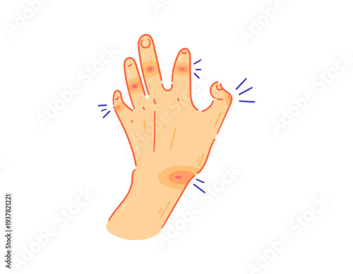 Arthritis concept. Pain in finger joints. Pain when bending fingers. Health problems. Illustration of a hand having difficulty bending its fingers due to pain. Flat style illustration with outline
