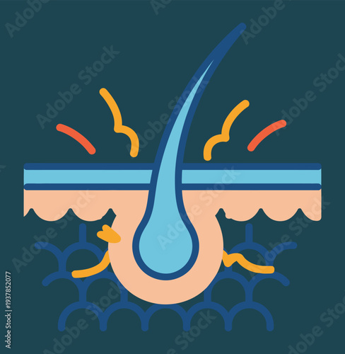 A detailed illustration of a hair follicle embedded in skin with signs of irritation or inflammation.