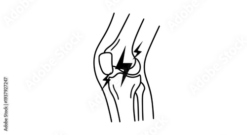 Knee pain medical icon with lightning symbol orthopedic health and bone injury concept vector