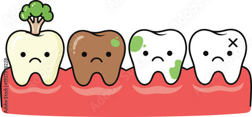  Healthy and unhealthy teeth stages cartoon dental care concept cavity decay plaque vector illustration for dentistry education