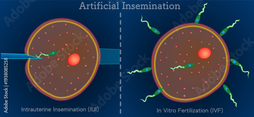 Artificial insemination ,AI. In vitro fertilization IVF. Infertility treatments, reproductive health. Dark background. Microbiology design. Illustration vector