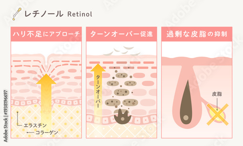 レチノールの作用メカニズム図解｜ハリ改善・ターンオーバー促進・皮脂抑制の美容イラスト