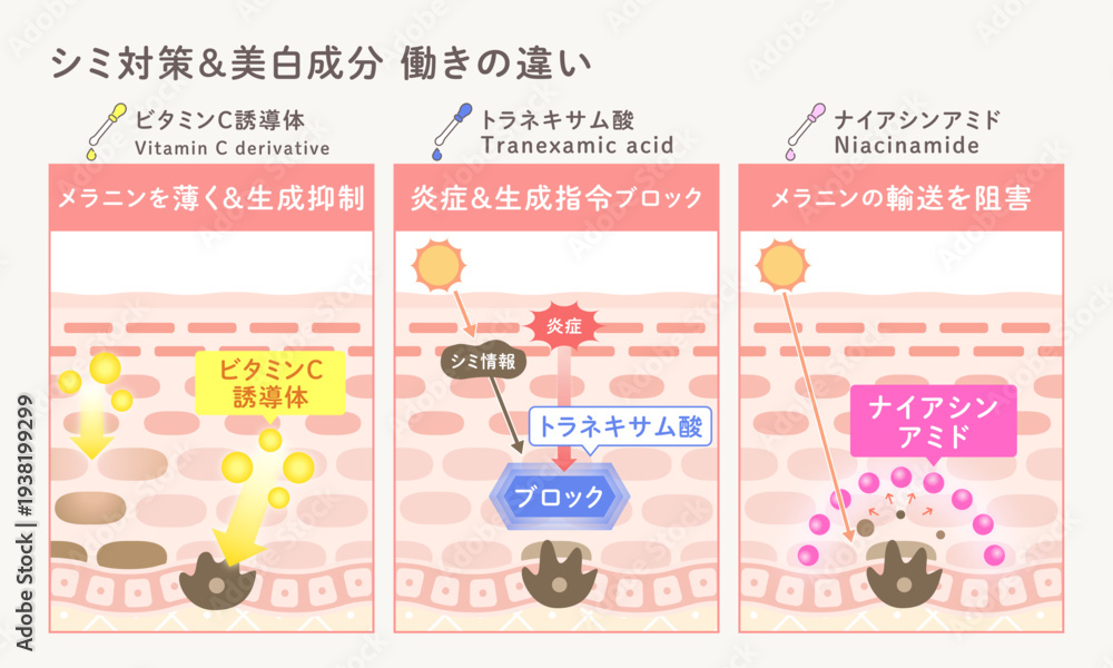 Obraz premium シミ対策・美白成分の働きの違いを解説した図解｜ビタミンC誘導体・トラネキサム酸・ナイアシンアミド