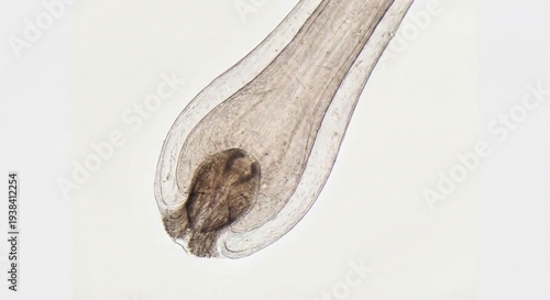 Microscopic view of human hair bulb and dermal papilla
