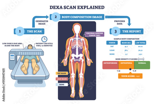 DEXA scan explained illustrates low-dose X-ray imaging yielding body composition and bone density report, key objects, scanner table, human anatomy figure, results chart, transparent background.