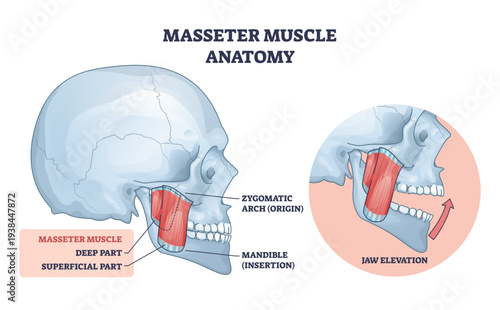 Masseter anatomy, labeled masseter muscle linking zygomatic arch to mandible, illustrating jaw elevation and chewing function, key objects, masseter, skull, mandible, transparent background.