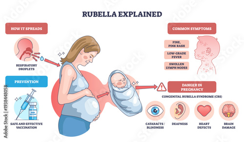 Rubella explained shows how infection spreads, risks in pregnancy and newborn outcomes, key elements, pregnant woman, infant, vaccine icons, transparent background.