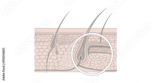Detailed illustration of human skin layers and hair follicles.