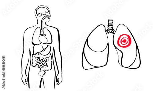 Lung disease concept