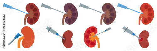  BIOPSY NEEDLE - Thin medical needle touching a kidney section  Flat Vector Illustration on Transparent Background