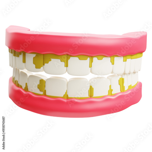A 3D rendering of a set of dentures with visible food debris, highlighting dental hygiene concerns