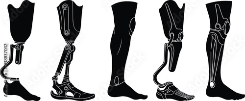 Prosthetic leg silhouette vector set, artificial limb and bionic prosthesis collection for disabled rehabilitation, medical technology mobility support illustration isolated