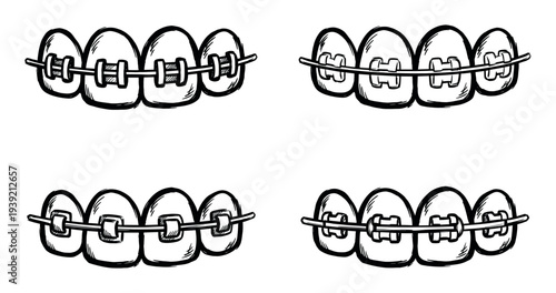 Set of four hand-drawn dental braces on teeth showing different types of orthodontic brackets in a black and white sketch style illustration