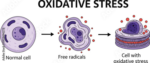 Oxidative stress process vector illustration showing normal cell, free radicals damage, and stressed cell, educational medical science diagram for health biology design