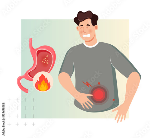 Stomach Tumour Growth - Gastric Cancer - Acidity Burn - Stock Illustration