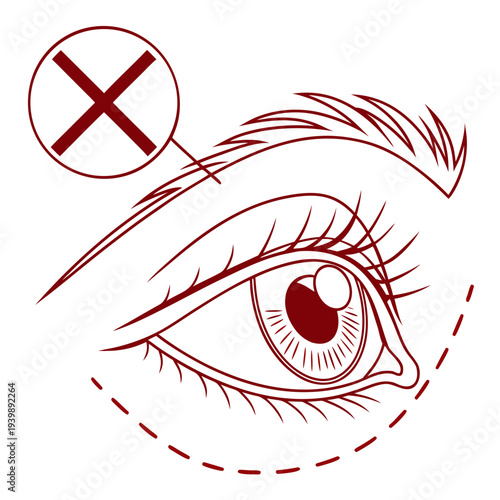 Bags under eyes removal forbidden, warning against cosmetic surgery on sensitive area, illustration of eye with prohibition sign