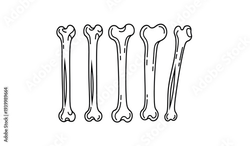 Set of five femur bones in various conditions