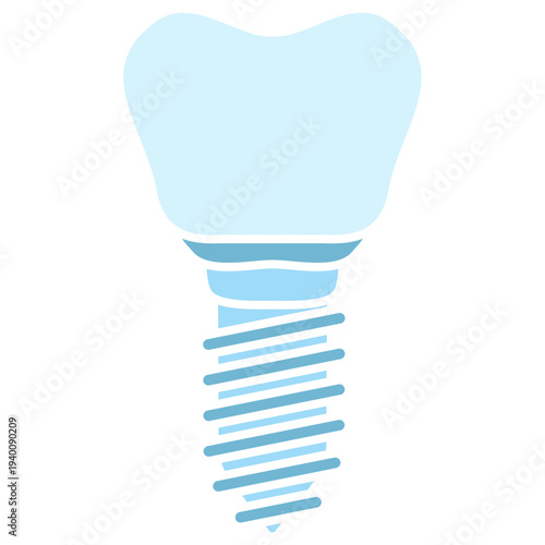 Dental Implant Illustration
