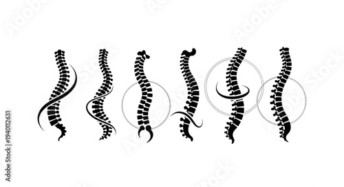 Various human spine illustrations showcasing different curvatures and angles.