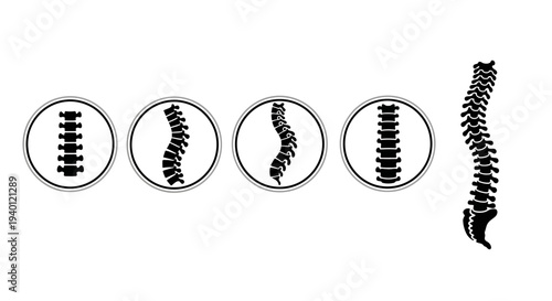 Human spine anatomy illustration showing different curvatures and alignment.