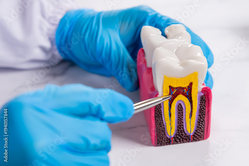 Un dentiste examine un modèle de dent avec des gants bleus et un pic dentaire.