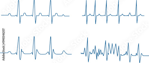 Collection of electrocardiogram heartbeat waveforms showing different cardiac rhythm patterns and medical pulse monitoring signals isolated on light background healthcare design