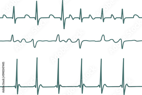 Green electrocardiogram heartbeat waveform collection showing different cardiac rhythm patterns and medical pulse monitoring signals isolated on light background for healthcare design