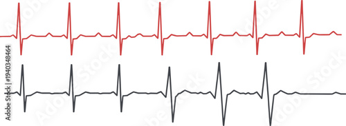Red and black electrocardiogram heartbeat waveform showing cardiac rhythm monitoring and medical pulse signals isolated on light background for healthcare technology design