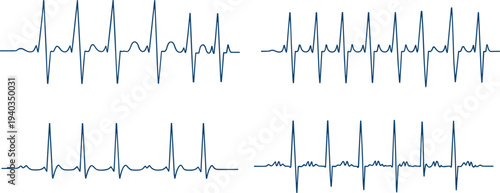 Set of electrocardiogram heartbeat waveforms showing cardiac rhythm monitoring and medical pulse signals isolated on light background for healthcare and cardiology design