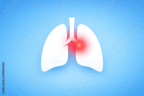 A graphic illustration of lungs with a red highlighted area indicating a problem or disease, shown against a blue gradient background from a front viewpoint.