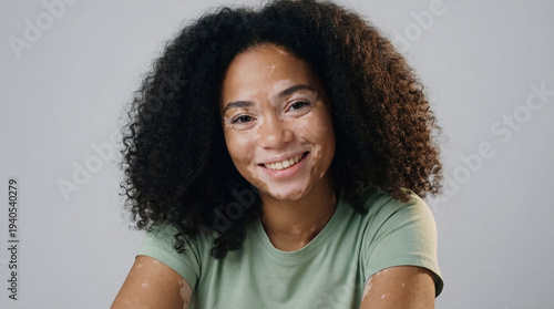 Portrait of a happy and confident young woman with vitiligo skin condition smiling on a neutral background.