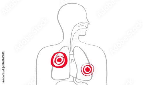 Lung disease concept