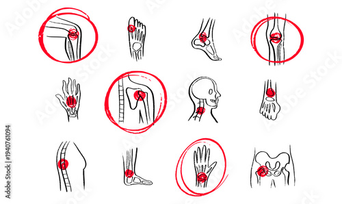 Arthritis Sketch Poster