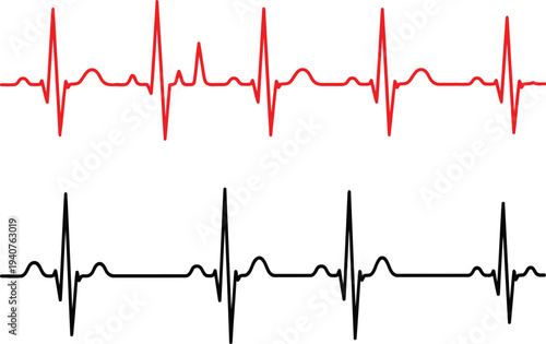 Comparison of electrocardiogram signals showing normal and irregular heartbeats Vector