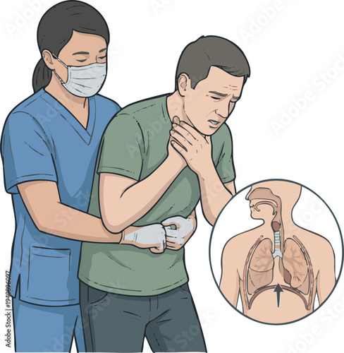 First Aid Back Blows and Abdominal Thrusts for Choking Relief