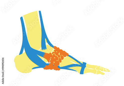 Anatomy of the Foot: Tendons and Ligaments