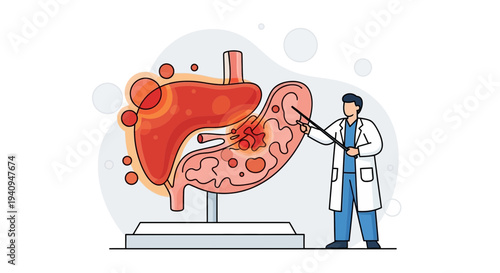 Doctor Explains Stomach Cancer Diagnosis and Treatment on Anatomical Model
