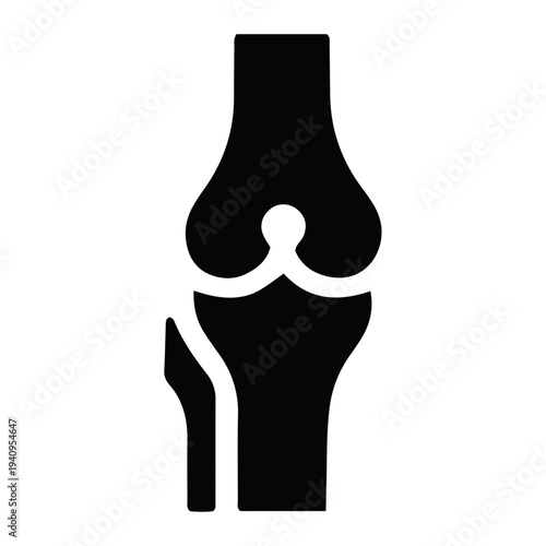 Anatomical illustration of a knee joint fracture showing mitocondrial rich tissue surrounding the bone structure in a medical context