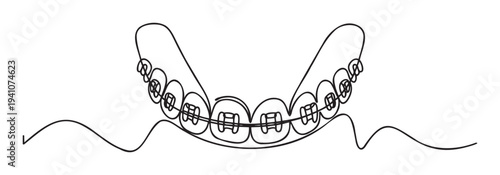 Continuous line drawing of human teeth with dental braces, representing orthodontic treatment and oral care, suitable for dentistry education and health clinic promotion