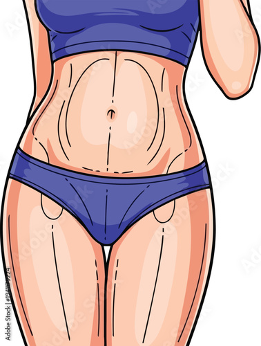 Woman body with cosmetic surgery contour lines vector graphic