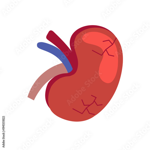 Red kidney cartoon style organ icon with blood vessels and subtle crack marks, medical anatomy illustration isolated on white for health and biology concepts