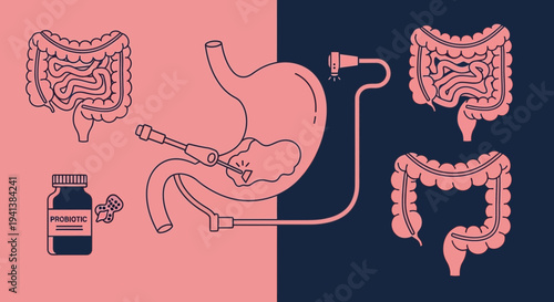 Illustration contrasting endoscopic treatment in the stomach with healthy and potentially diseased intestines