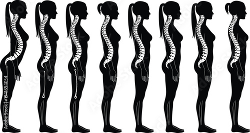 Female Spine Posture Silhouette Sequence Showing Human Body Alignment, Back Pain, Spinal Curve and Healthy Posture Correction Medical Illustration
