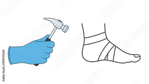 Neurological Reflex Hammer Test on Ankle, Clinical Physical Therapy and Diagnostic Assessment Illustration