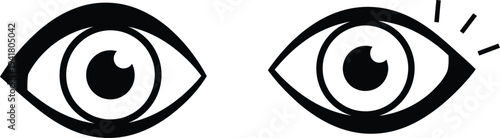 A pair of cartoon eyes with one eye looking surprised