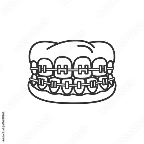 Orthodontic Braces on Teeth - Dental Care Illustration.