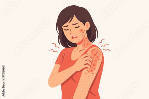 Vector illustration of a woman suffering from skin rash symptoms like hives or eczema due to a food allergy, scratching her itchy arm and neck in distress, simple flat design for healthcare.